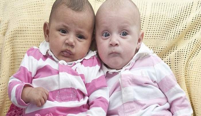 Μια στο εκατομμύριο – Γεννήθηκαν δίδυμα κοριτσάκια με διαφορετικό χρώμα [εικόνες]