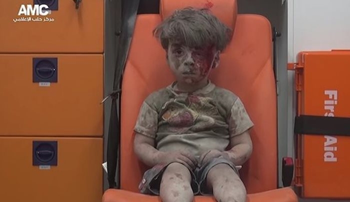 Το βλέμμα του μικρού παιδιού που μας στοιχειώνει όλους! 300.000 κάτοικοι της Συρίας έχουν σκοτωθεί
