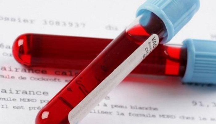 Φερριτίνη: Πότε οι τιμές της στο αίμα δείχνουν κίνδυνο σοβαρών ασθενειών