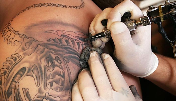 Αφαίρεση τατουάζ: Πώς γίνεται; Πόσο αποτελεσματική είναι; Πότε θα έρθει στην Κω;