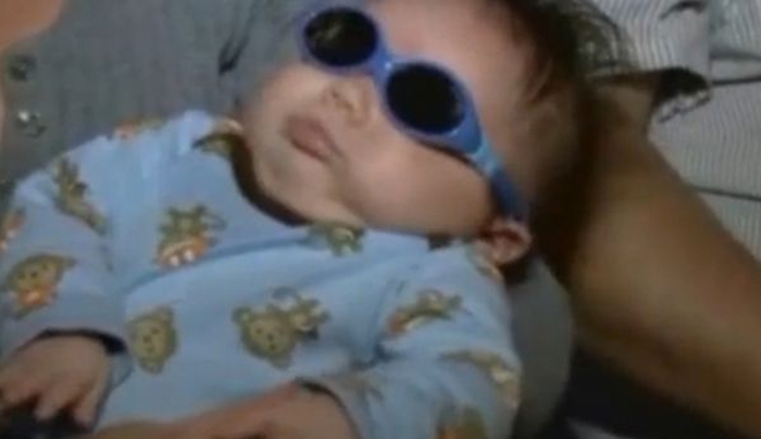 ΠΡΟΣΟΧΗ ΣΚΛΗΡΕΣ ΕΙΚΟΝΕΣ: Μωράκι γεννήθηκε χωρίς μάτια! [photos]
