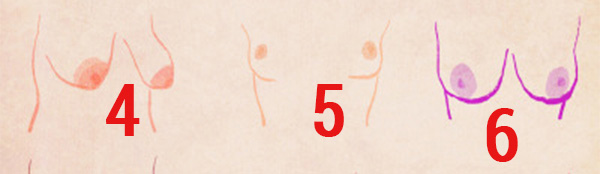 st2