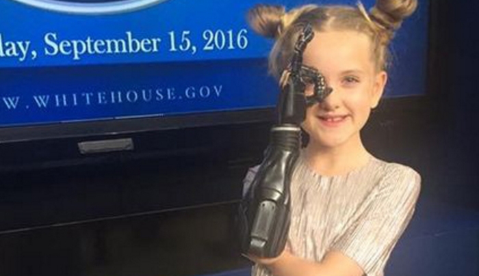 Η 11χρονη χωρίς χέρια που βοηθάει στο σχεδιασμό προσθετικών άκρων