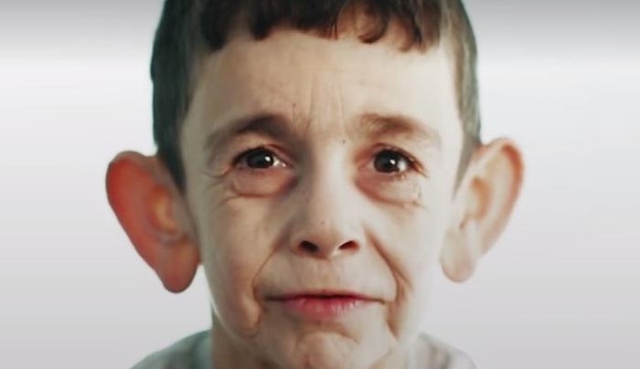 Προγηρία: Ο 7χρονος που “ζει στο σώμα” 70χρονου – Συγκλονίζουν οι εικόνες [βίντεο]