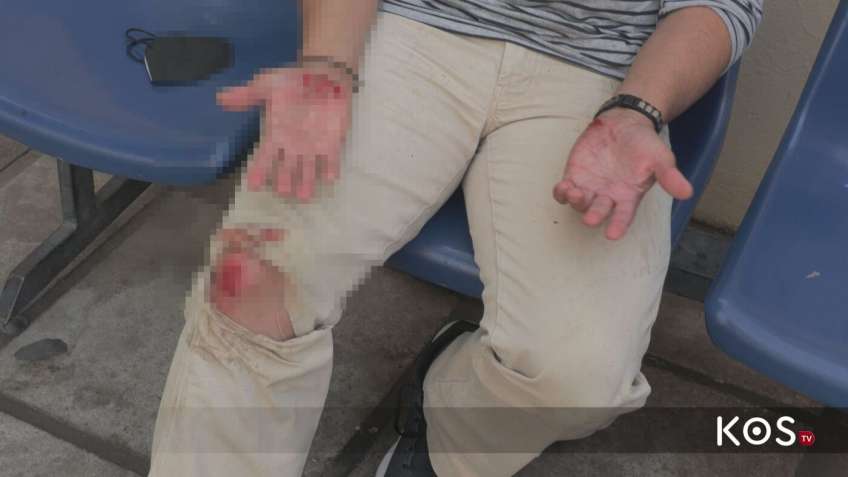 Επίθεση σκύλου σε μαθητή στο Ζηπάρι. Με άμεση επέμβαση συμπολίτη μας, αποφεύχθησαν τα χειρότερα