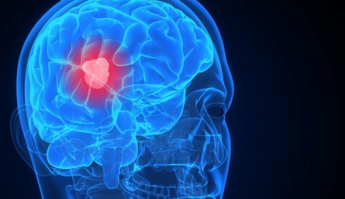 Οι επιστήμονες αναχαιτίζουν τον καρκίνο στο κεφάλι