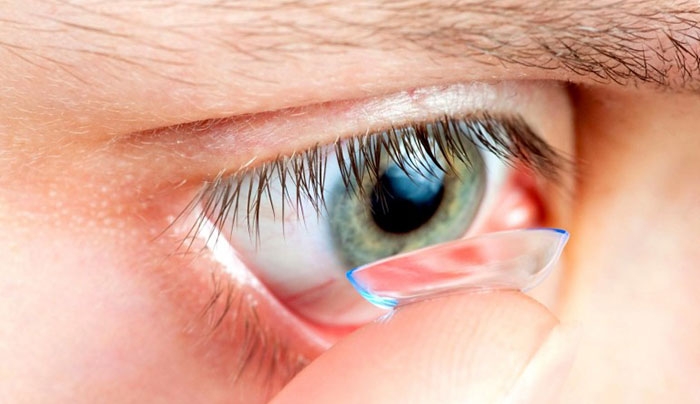 Τα 5 επικίνδυνα λάθη που κάνουμε όσοι χρησιμοποιούμε φακούς επαφής