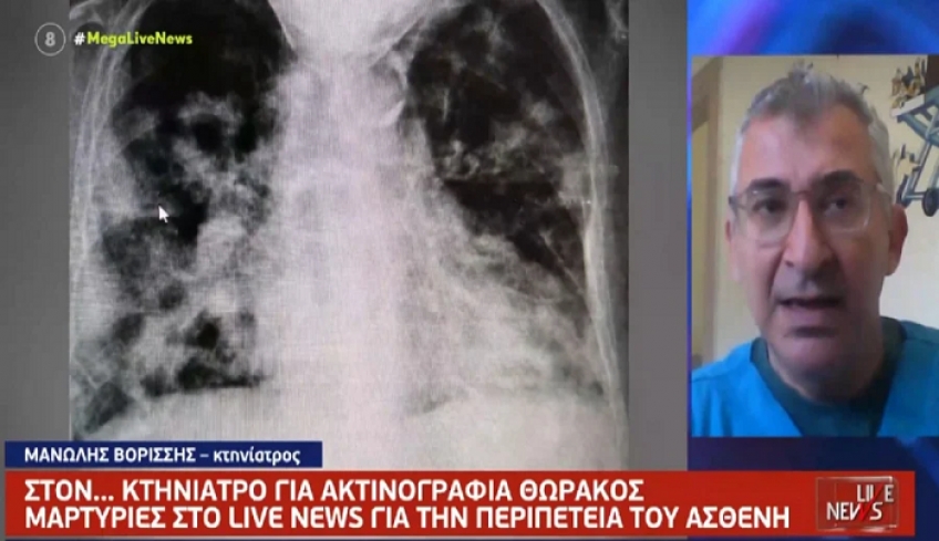 Απίστευτο περιστατικό στην Τήνο, πήγε για ακτινογραφία σε κτηνίατρο λόγω βλάβης στο Κέντρο Υγείας (βίντεο)