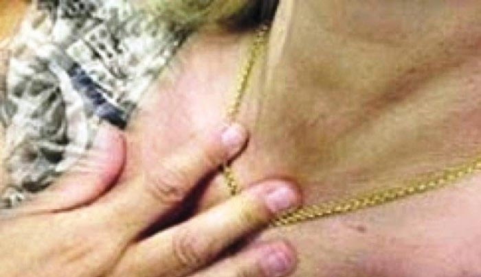 Ρόδος: Τσιγγάνοι άρπαξαν χρυσή αλυσίδα από τον λαιμό γυναίκας