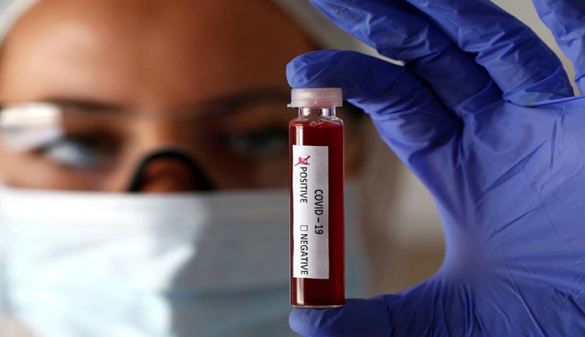 Κορωνοϊός – 3.605 κρούσματα, 20 θάνατοι και 240 διασωληνωμένοι