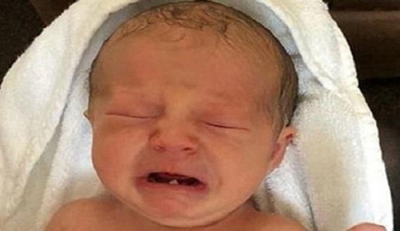 Στον οδοντίατρο για εξαγωγή δοντιού σε ηλικία μόλις 12 ημερών - ΦΩΤΟ