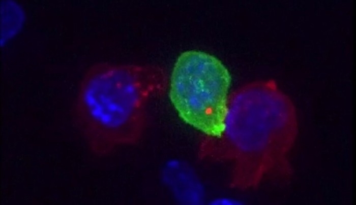 Απίστευτο βίντεο! Τα κύτταρα Τ εξολοθρεύουν τα καρκινικά κύτταρα