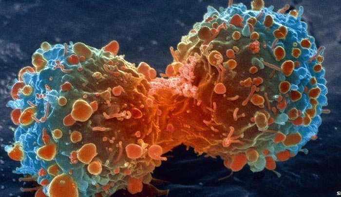 Σπουδαία ιατρική ανακάλυψη - Επιστήμονες εντόπισαν την «αχίλλειο πτέρνα» του καρκίνου