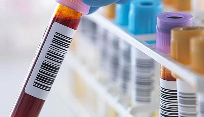 Νέο τεστ αίματος ανιχνεύει τον καρκίνο του οισοφάγου έως δέκα χρόνια πριν από τα πρώτα συμπτώματα