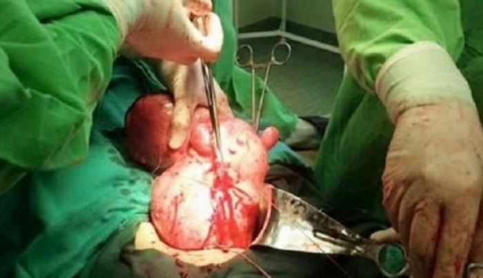 Πήγε να γεννήσει αλλά δεν έβγαλε μωρό!