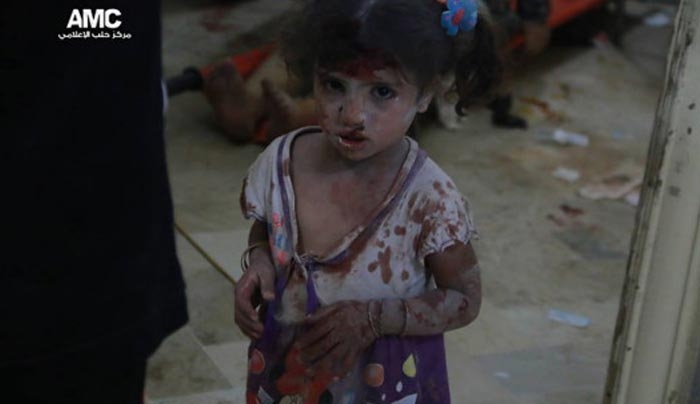 Συρία: ΣΚΛΗΡΕΣ ΕΙΚΟΝΕΣ- Δεν πρόλαβε να τελειώσει η εκεχειρία και βομβάρδισαν παιδιά [φωτό-βίντεο]