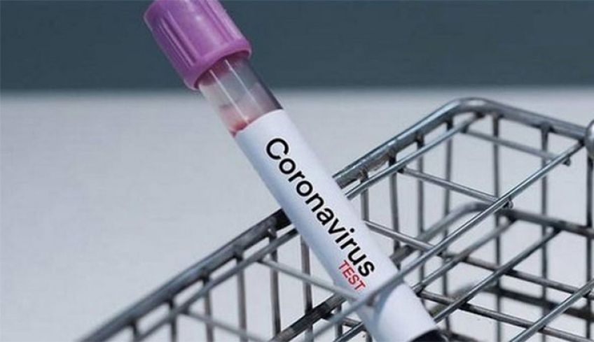 ΠΡΟΛΗΠΤΙΚΑ ΜΕΤΡΑ ΓΙΑ ΤΟΝ ΚΟΡΩΝΟΪΟ ΣΤΑ ΣΧΟΛΕΙΑ