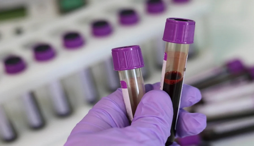 Ανησυχητική έρευνα: Βρέθηκαν για πρώτη φορά μικροπλαστικά στο ανθρώπινο αίμα