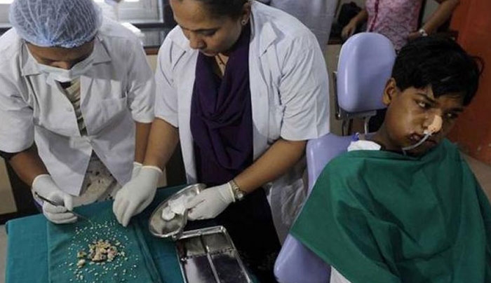 Ινδία: Γιατροί αφαίρεσαν από ανήλικο... 80 δόντια!