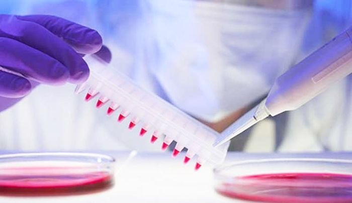 Νέο τεστ αποκαλύπτει όλες τις λοιμώξεις από ιούς σε μια μόνο σταγόνα αίματος