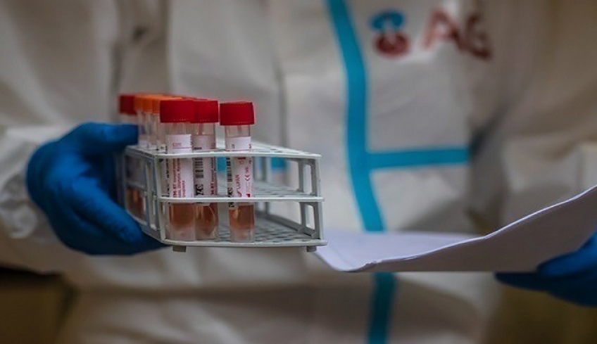 Α. Γεωργιάδης: Επανεξέταση του πλαφόν στην τιμή των pcr τεστ – Όλα τα μέτρα στο τραπέζι πλην του lockdown