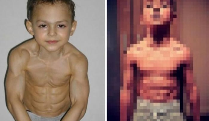 Πως είναι σήμερα ο 11χρονος bodybuilder που έχει μπει 2 φορές στο βιβλίο Guinness; (Βίντεο)