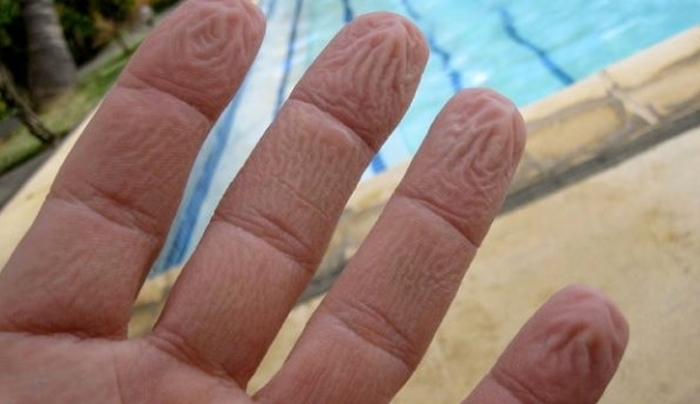 Όταν τα δάχτυλά σας ζαρώνουν στο νερό, δεν είναι επειδή «μούλιασαν»...
