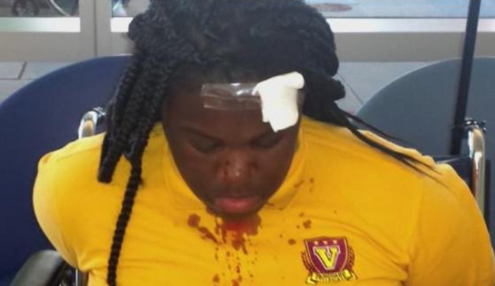 Αστυνομικός χτύπησε με γκλομπ μαθήτριες - BINTEO
