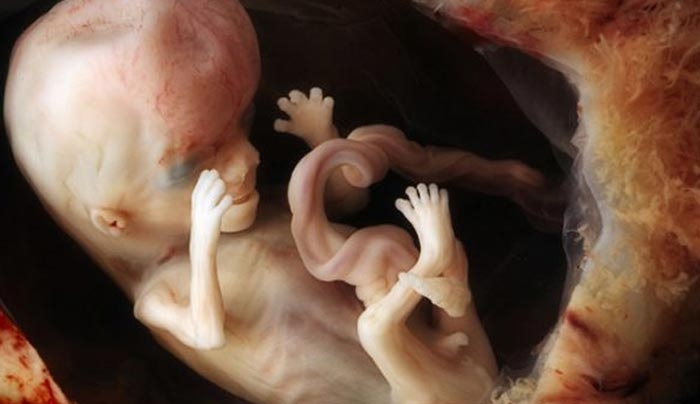Ρεαλιστικές φωτογραφίες: Καρέ καρέ η ανάπτυξη του εμβρύου μέσα στη μήτρα