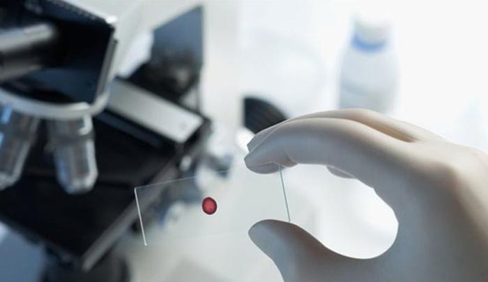 Ουραγός η Ελλάδα σε δότες αίματος, μυελού και ομφάλιου αίματος