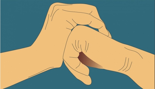 "Κρακ" στα δάχτυλα και αρθρίτιδα: Δείτε τι ισχύει!