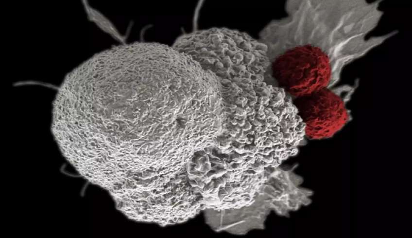 Καρκίνος του μαστού: Ελπίδες από το φάρμακο της Astrazeneca – Θαυματουργό σκεύασμα εξαφανίζει τον καρκίνο του ορθού