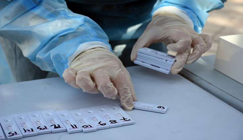 Αποτελέσματα δειγματοληψιών από τις ΚΟΜΥ του ΕΟΔΥ (10-08-2022) – 14 θετικά στην Π.Ε. Κω