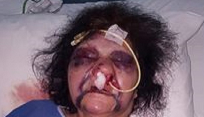 Υπέκυψε η 80χρονη γυναίκα που φέρεται να ξυλοκοπήθηκε αγρίως!