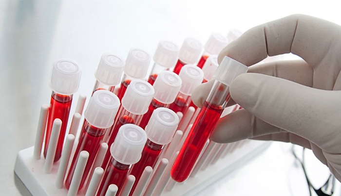 Τεστ αίματος διακρίνει αν η λοίμωξη οφείλεται σε ιό ή βακτήριο